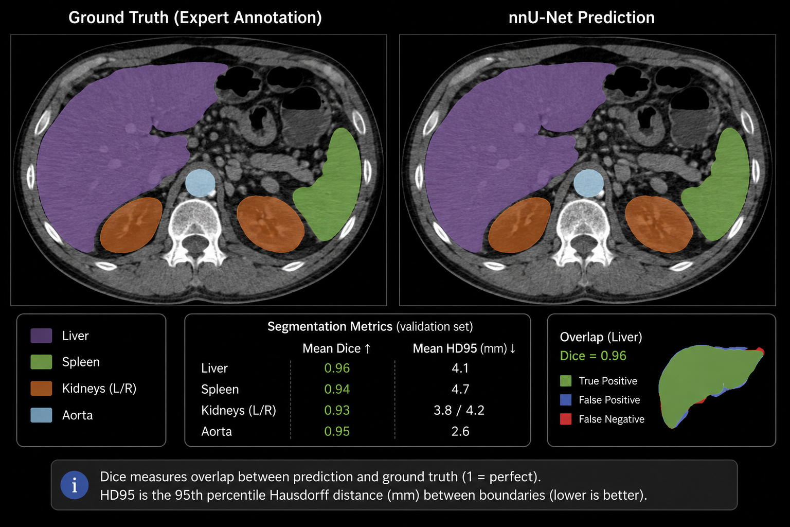 Ground-truth vs. predicted mask