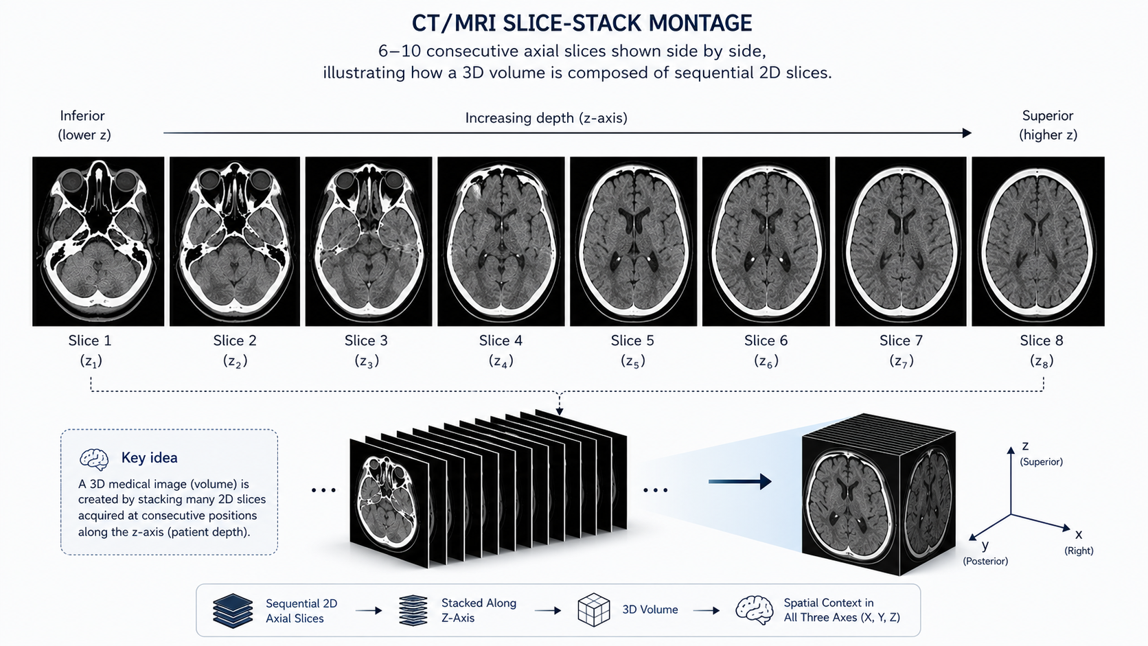 CT/MRI slice-stack montage